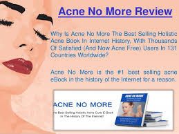 Acne no more