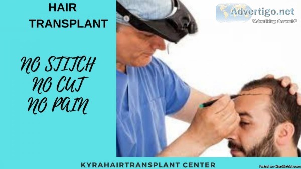 Hair transplant clinic in Ludhiana