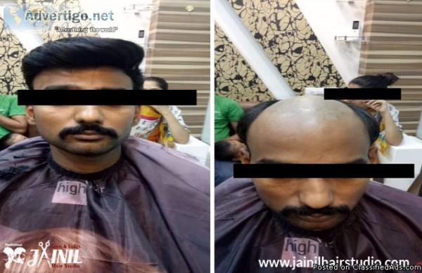 Hair Fixing  Jainil Hair Studio Vadodara