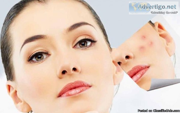 Top Acne Scar Laser Treatment In Ludhiana  DrShikhaAggarwal