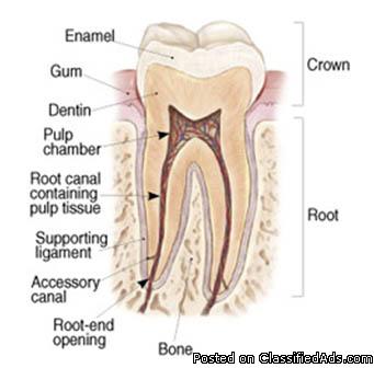 Root Canal Specialist in Whitefield