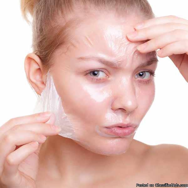 Chemical Peel for Acne in Gurgaon