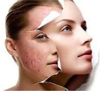 Best Skin Whitening Treatment n Chennai