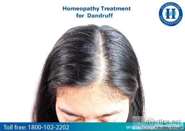 Homeopathy Treatment For Dandruff