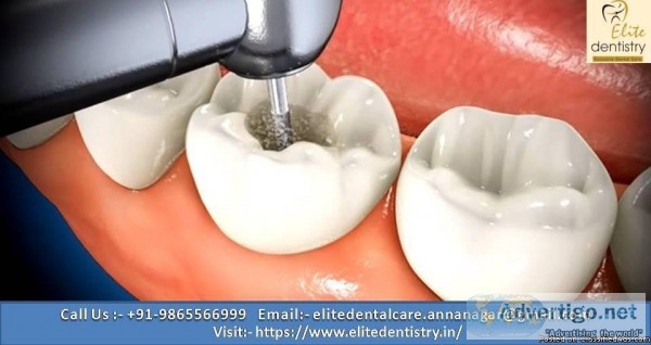 Best Dental Clinics in Chennai