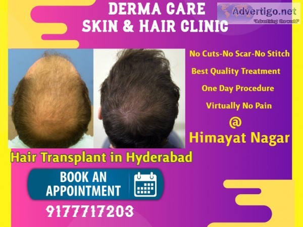 Hair growth treatment in hyderabad 