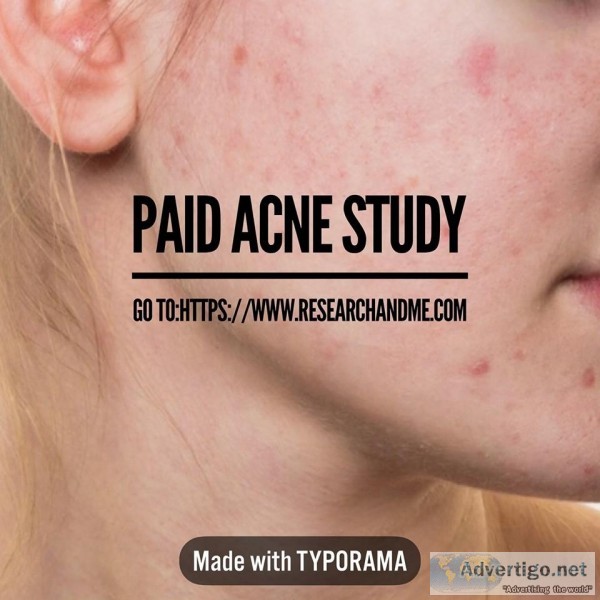 Paid Rosacea Study