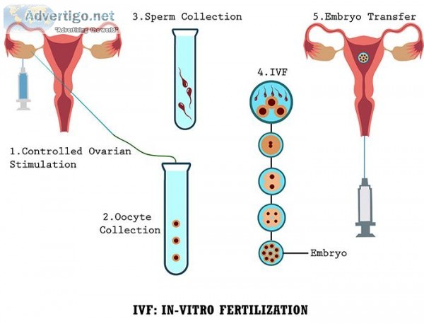 Best Ivf Treatment In Chennai