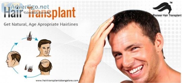 FUE Hair Transplant Center in Bangalore