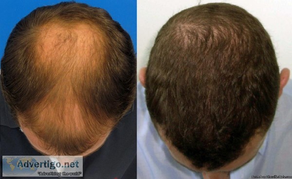 Professional Hair Transplant and Plastic Surgery