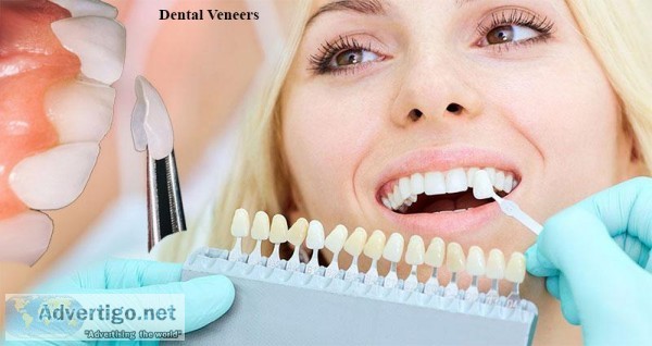 Dental Veneers  Cosmetic Dentistry Auburn  Cheap Dental Implants