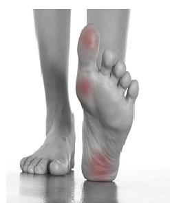 Alleviate Common Foot Problems With Custom Foot Orthotics in Bur