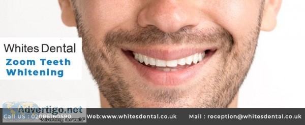 Zoom Teeth Whitening London