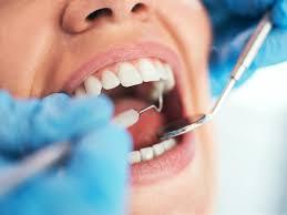 Dental Implants Near Me