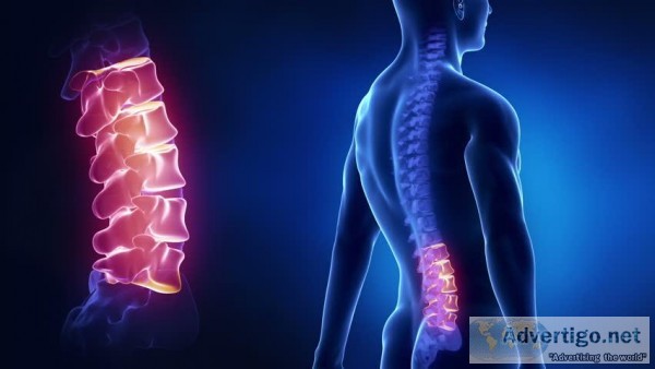 Scoliosis Spine Surgery Cost in India  Scoliosis Treatment in In