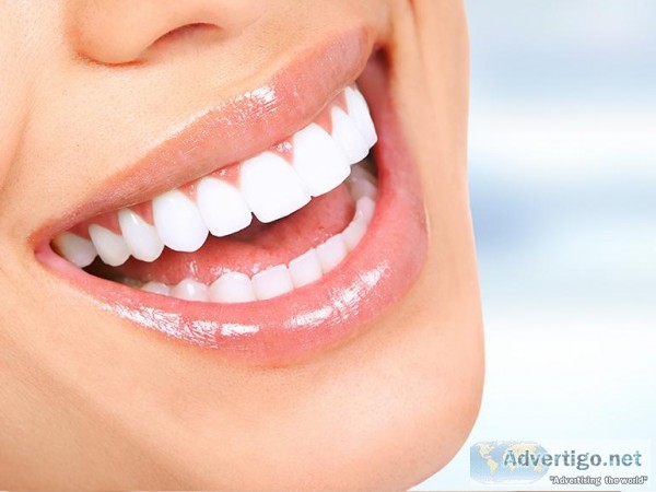 Cosmetic Dentistry Treatments in La Mesa