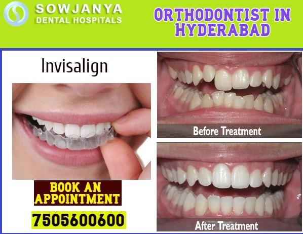 Orthodontist in Hyderabad- Popular Doctors in Hyderabad