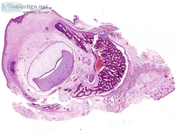Looking for Best Oral histology services in Delhi NCR India