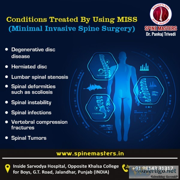 Jalandhar  Spine Masters Spine Surgeon  Laser Disc Surgery