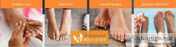 Plainview Laser Toenail Fungus Treatment