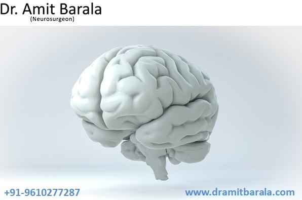 Best Neurosurgeon Doctor in Jaipur