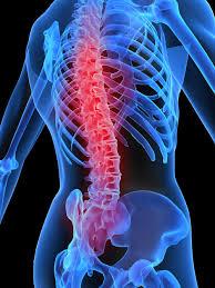 Diagnostic Testing X-Rays EMG&rsquos and NCV&rsquos