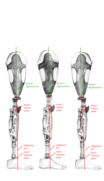 Waterproof Prosthetic Leg by Rinella Prosthetics and Orthotics