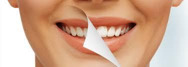 Best Porcelain Veneers in Hobart