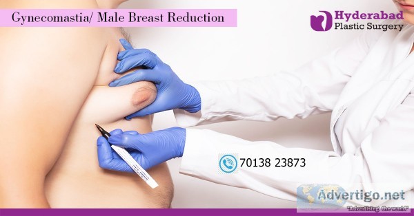 Hyderabadplasticsurgery