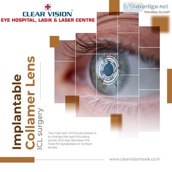 Eye Checkup Hospital in Himayath Nagar  Best Laser Centre in Hyd