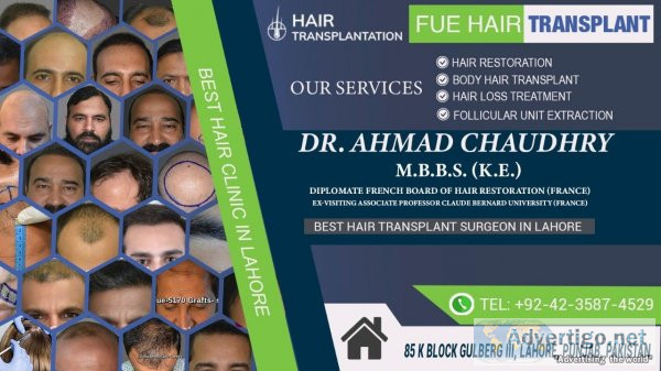 Lahore hair transplant