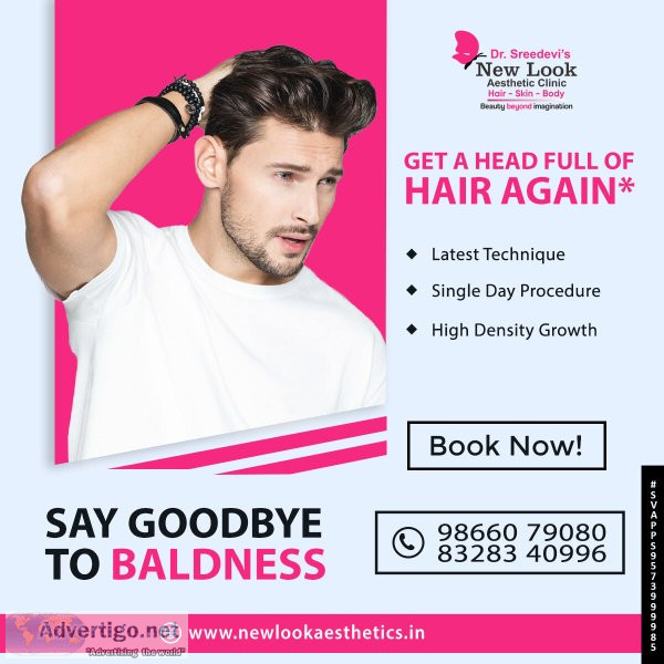 Best hair transplant clinic in hanamkonda