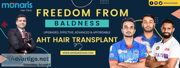 Hair transplant in indore