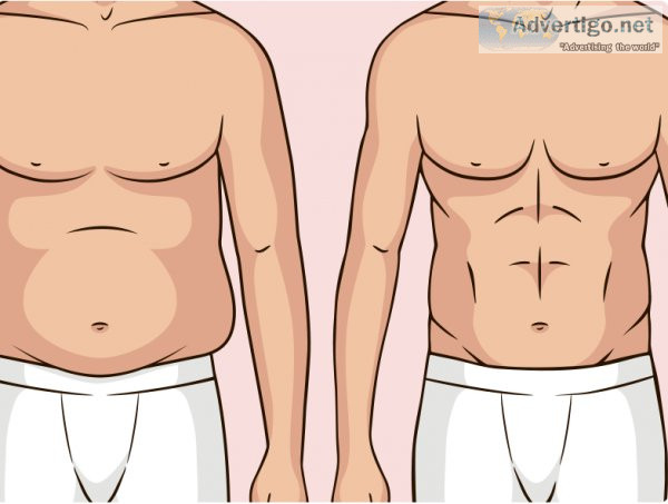 Liposuction in lahore