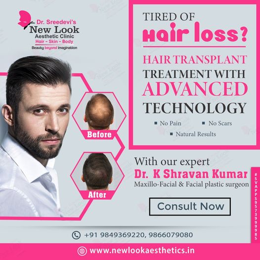 Best hair transplant clinic in hanamkonda