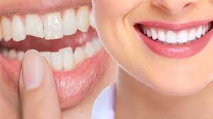 Teeth cleaning and teeth scaling in pune | teeth cleaning in shi