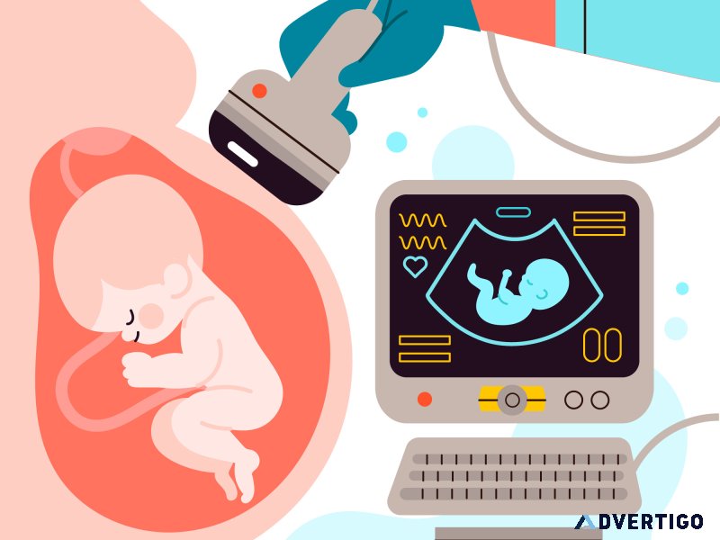 Minimal stimulation ivf in kenya- myra ivf