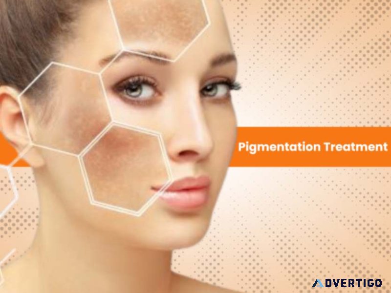 Before and after: real results from pigmentation treatment kits