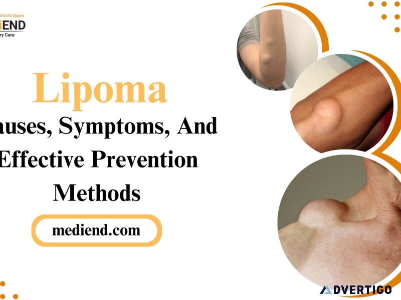 Lipoma causes, symptoms, and effective prevention methods