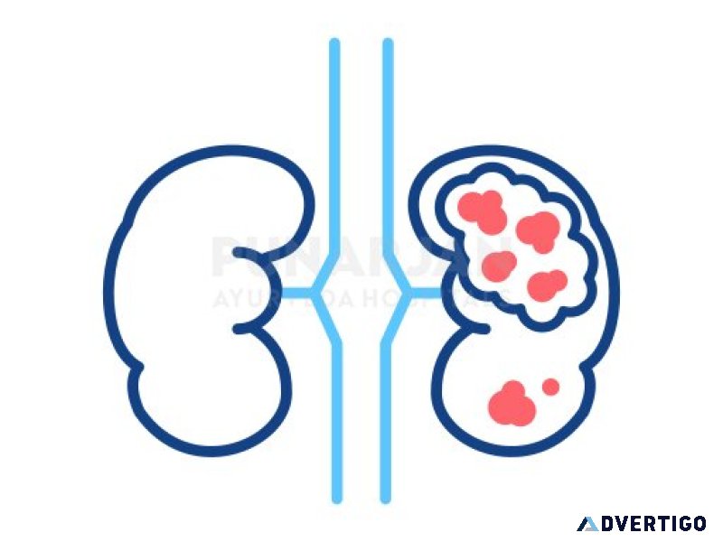 Best kidney cancer treatment hospitals in hyderabad