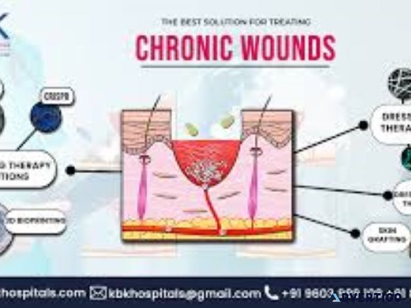 Causes of non-healing wounds