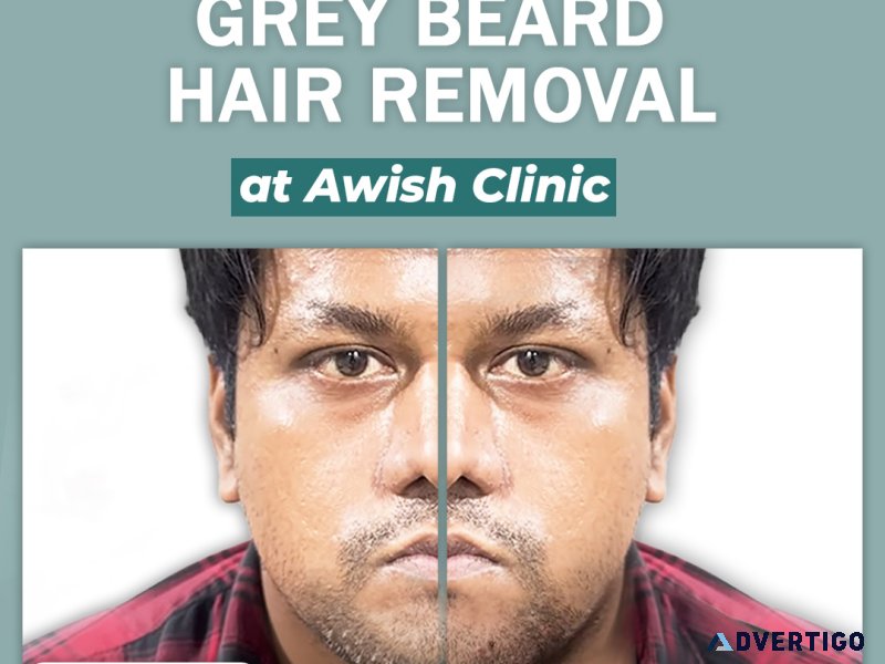 Grey beard treatment in delhi ncr