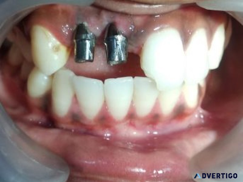 Dentist in faridabad sector 9