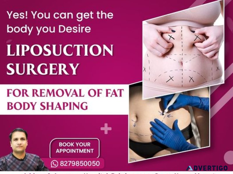 Liposuction surgery in ncr