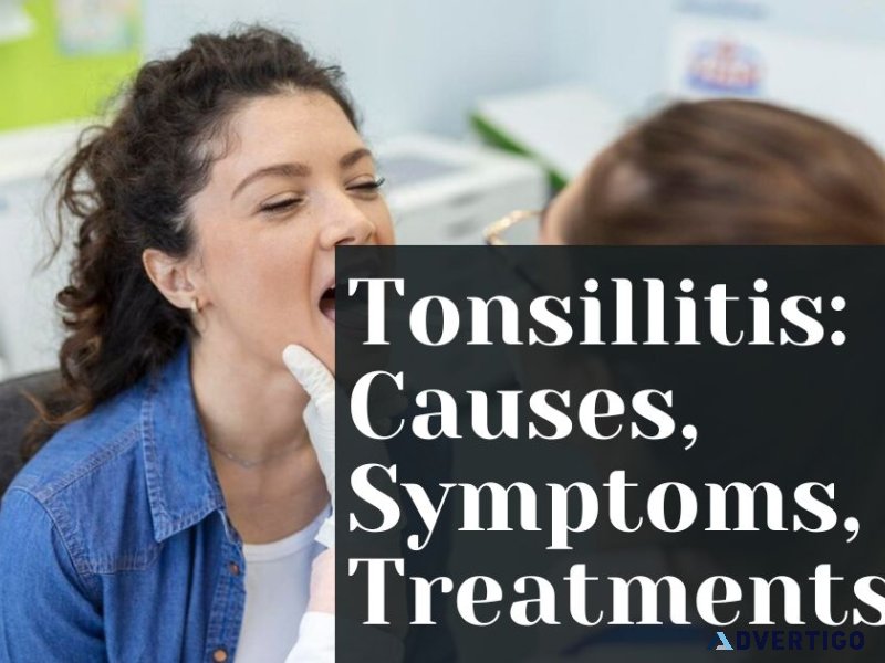 Tonsillitis: causes, symptoms, and treatments