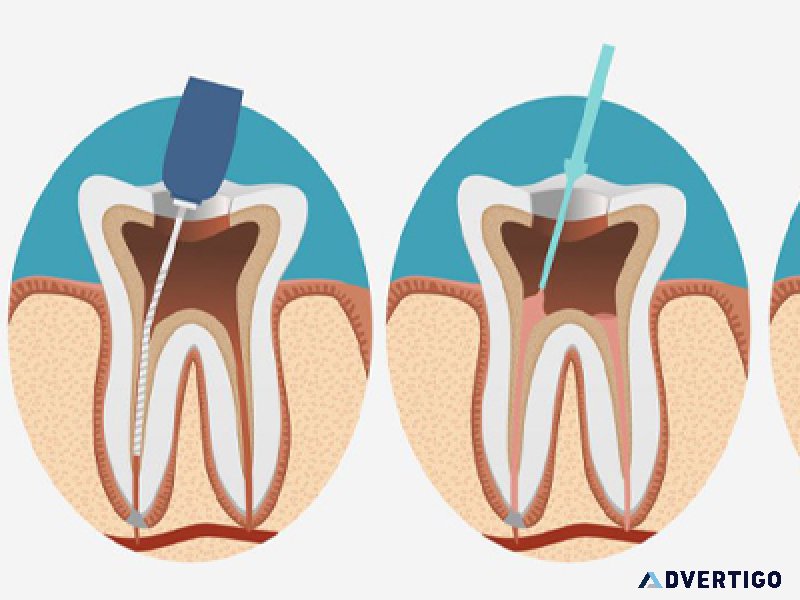 Best dentist in zirakpur : gupta smile clinic