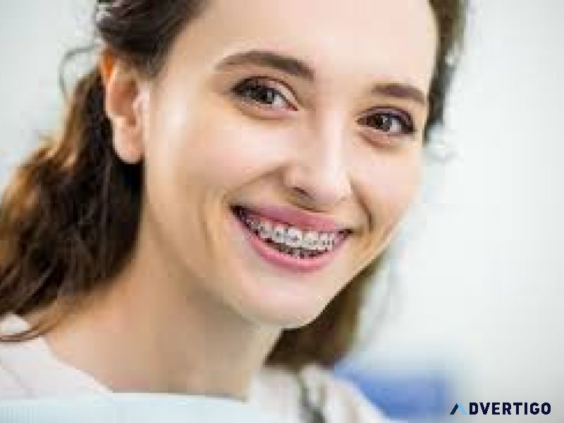 Braces adjustment in abudhabi