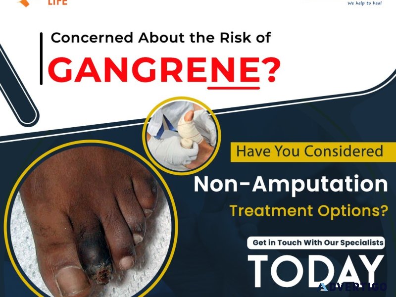 Best gangrene treatment in india