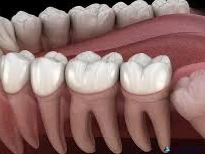 Tooth removal cost in abudhabi