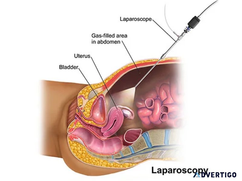 State-of-the-art fertility services in pune